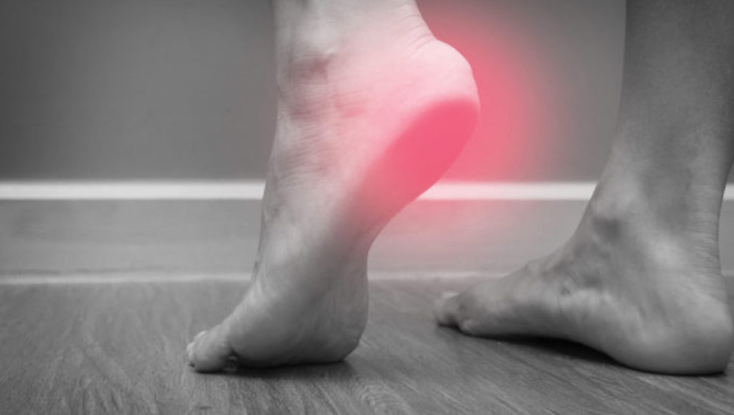 Plantar myoaponeurosis