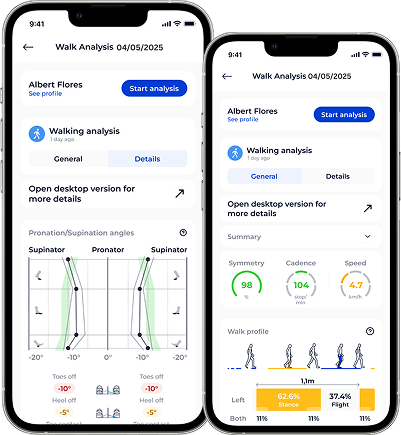 Dynamic Gait Analysis – Real Movement, Real Insight