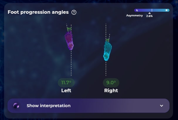 Baliston foot progression angle detail showing left and right foot orientations