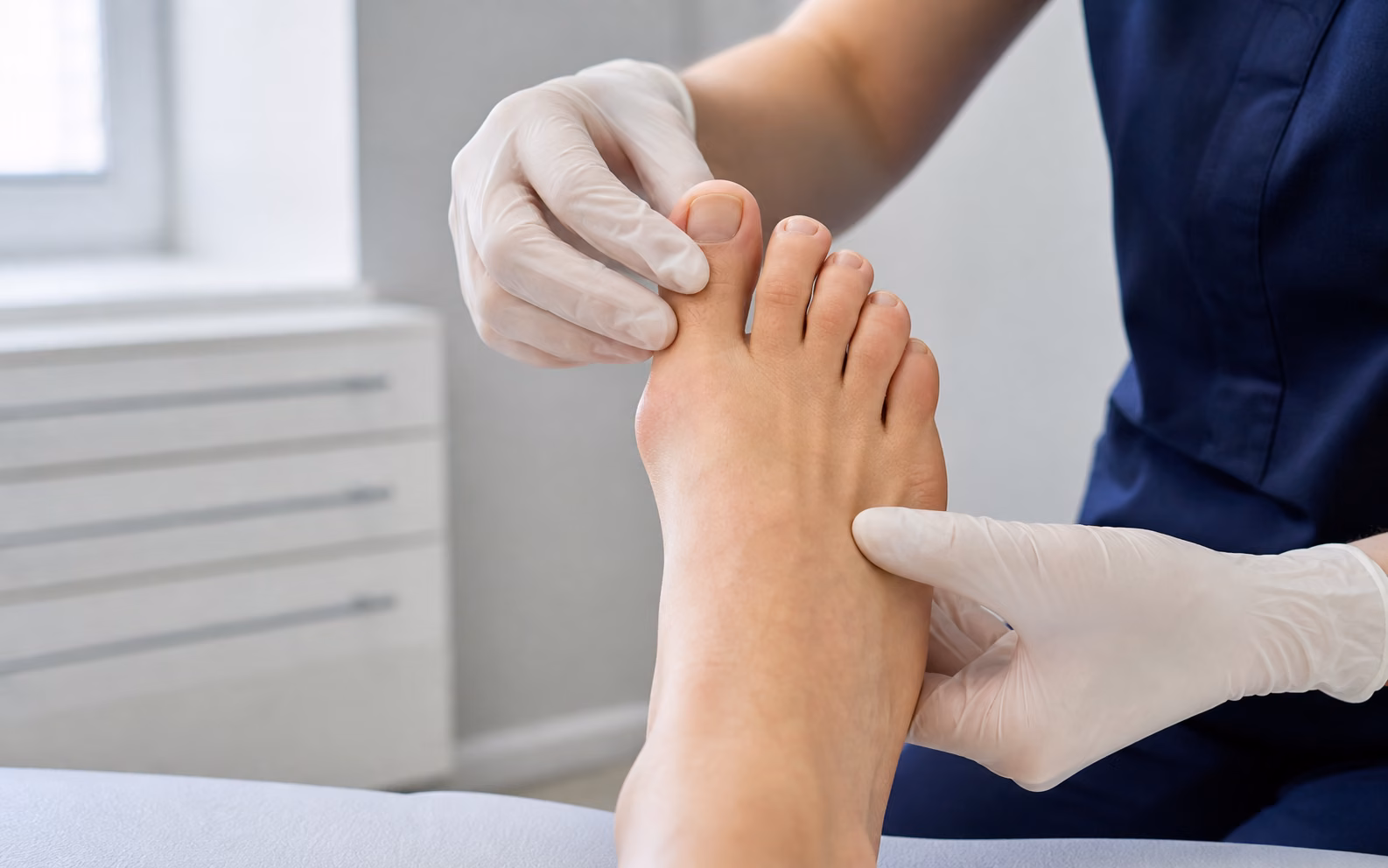 Hallux valgus (oignon) : la chirurgie est-elle inévitable ?